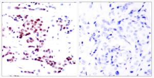 Antibody anti-STAT5A 100 µg