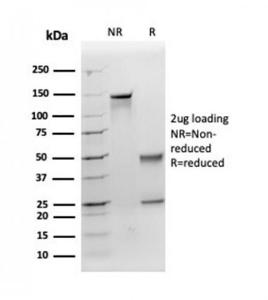 SDS-PAGE analysis of Anti-Apolipoprotein E Antibody [APOE/3671] under non-reduced and reduced conditions; showing intact IgG and intact heavy and light chains, respectively. SDS-PAGE analysis confirms the integrity and purity of the antibody.