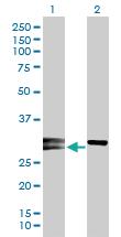 Anti-NOG Rabbit Polyclonal Antibody