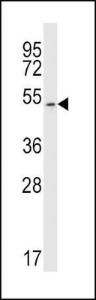 Anti-MAP Kinase 10 Rabbit Polyclonal Antibody (AP (Alkaline Phosphatase))