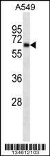 Anti-KCNA3 Rabbit Polyclonal Antibody (AP (Alkaline Phosphatase))