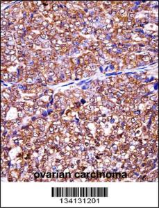 Anti-EIF5A2 Rabbit Polyclonal Antibody (HRP (Horseradish Peroxidase))