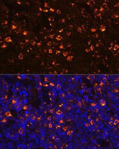 Immunofluorescence analysis of mouse spleen using Anti-CLEC4D Antibody (A9074) at a dilution of 1:100 (40X lens). DAPI was used to stain the cell nuclei (blue)