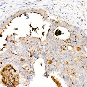 Immunohistochemistry analysis of paraffin-embedded human tonsil using Anti-CD63 Antibody [ARC51703] (A305333) at a dilution of 1:200 (40x lens). Perform high pressure antigen retrieval with 10 mM citrate buffer pH 6.0 before commencing with IHC staining protocol.