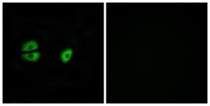 Immunofluorescence analysis of A549 cells using Anti-MRPS22 Antibody. The right hand panel represents a negative control, where the antibody was pre-incubated with the immunising peptide.