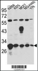 Anti-ERP29 Rabbit Polyclonal Antibody