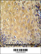 Anti-ERMARD Rabbit Polyclonal Antibody