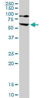 Anti-EZR Rabbit Polyclonal Antibody