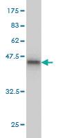 Anti-VHL Mouse Monoclonal Antibody [clone: 1G12]