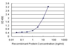 Anti-GSTZ1 Polyclonal Antibody Pair