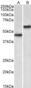 Anti-LYVE1 Antibody (A83506) (2 µg/ml) staining of Human Cerebellum (A) and Liver (B) lysates (35 µg protein in RIPA buffer) Primary incubation was 1 hour Detected by chemiluminescence