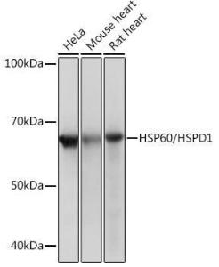 Western blot analysis of extracts of various cell lines, using Anti-HSP60 Antibody [ARC0260] (A309137) at 1:1,000 dilution. The secondary antibody was Goat Anti-Rabbit IgG H&L Antibody (HRP) at 1:10,000 dilution.