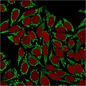 Antibody anti-HSP60 HSPD1875 BSA 100 µg