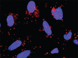 Anti-FAS + DAXX Antibody Pair