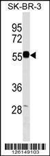 Anti-EEPD1 Rabbit Polyclonal Antibody (Biotin)