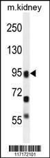 Anti-ALOXE3 Rabbit Polyclonal Antibody (APC (Allophycocyanin))