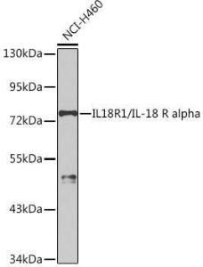 Western blot analysis of extracts of NCI-H460 cells, using Anti-IL-18R1 Antibody (A9075) at 1:1,000 dilution. The secondary antibody was Goat Anti-Rabbit IgG H&L Antibody (HRP) at 1:10,000 dilution.