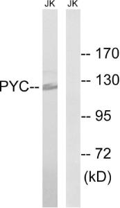 Western blot analysis of lysates from Jurkat cells using Anti-PC Antibody. The right hand lane represents a negative control, where the antibody is blocked by the immunising peptide