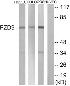 Western blot analysis of lysates from HUVEC, COLO, and COS cells using Anti-FZD9 Antibody The right hand lane represents a negative control, where the antibody is blocked by the immunising peptide