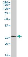 Anti-NOG Rabbit Polyclonal Antibody