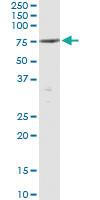 Anti-PTPN5 Antibody Pair