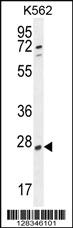 Anti-hCG_2024410 Rabbit Polyclonal Antibody