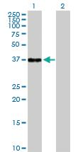 Anti-NFKBIB Rabbit Polyclonal Antibody