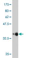 Anti-PCDHGC5 Mouse Monoclonal Antibody [clone: 3A6]