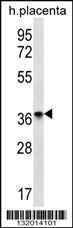 Anti-OR8D4 Rabbit Polyclonal Antibody (Biotin)