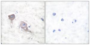 Immunohistochemical analysis of paraffin-embedded human brain tissue using Anti-SNAP25 Antibody. The right hand panel represents a negative control, where the antibody was pre-incubated with the immunising peptide.