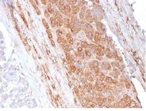 Immunohistochemical analysis of formalin-fixed, paraffin-embedded human adrenal gland tissue using Anti-Apolipoprotein E Antibody [APOE/3671]