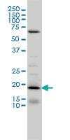 Anti-NSG1 Mouse Monoclonal Antibody [clone: 1C3]