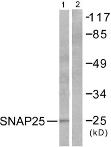 Western blot analysis of lysates from Raw264.7 cells, treated with EGF 200ng/ml 30' using Anti-SNAP25 Antibody. The right hand lane represents a negative control, where the antibody is blocked by the immunising peptide.