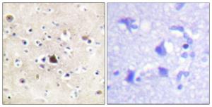 Immunohistochemical analysis of paraffin-embedded human brain tissue using Anti-GR Antibody. The right hand panel represents a negative control, where the antibody was pre-incubated with the immunising peptide