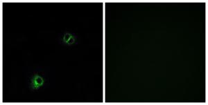 Immunofluorescence analysis of A549 cells using Anti-FZD9 Antibody The right hand panel represents a negative control, where the antibody was pre-incubated with the immunising peptide