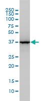 Anti-ALDOA Mouse Monoclonal Antibody [clone: 3C12-6D11]