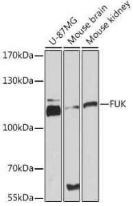 Anti-FUK antibody