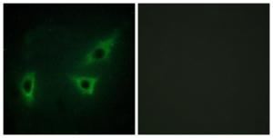 Immunofluorescence analysis of HeLa cells using Anti-ATP7B Antibody. The right hand panel represents a negative control, where the antibody was pre-incubated with the immunising peptide.