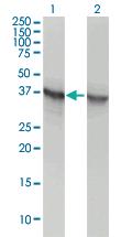 Anti-ALDOA Mouse Monoclonal Antibody [clone: 3C12-6D11]