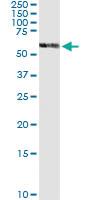 Anti-PDHX Polyclonal Antibody Pair