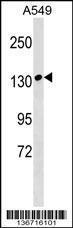 Anti-MYBPC1 Rabbit Polyclonal Antibody (Biotin)