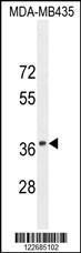 Anti-CADM1 Rabbit Polyclonal Antibody (HRP (Horseradish Peroxidase))