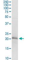 Anti-NSG1 Mouse Monoclonal Antibody [clone: 1C3]