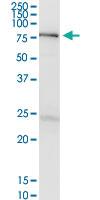 Anti-EZR Rabbit Polyclonal Antibody