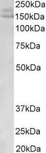 Anti-AKAP12 Antibody (A83509)(0.02 µg/ml) staining of Human Uterus lysate (35 µg protein in RIPA buffer). Primary incubation was 1 hour. Detected by chemiluminescence