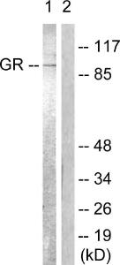 Western blot analysis of lysates from Jurkat cells, treated with EGF 200ng/ml 15' using Anti-GR Antibody. The right hand lane represents a negative control, where the antibody is blocked by the immunising peptide