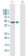 Anti-GAK Rabbit Polyclonal Antibody