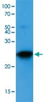 Anti-BAK Mouse Monoclonal Antibody