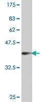 Anti-CHAD Mouse Polyclonal Antibody