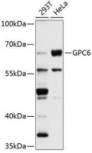 Western blot analysis of extracts of various cell lines, using Anti-Glypican 6 Antibody (A9081) at 1:1000 dilution